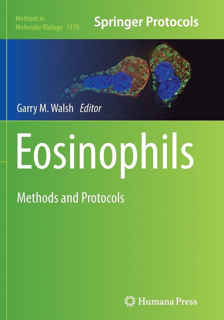 Eosinophils 1