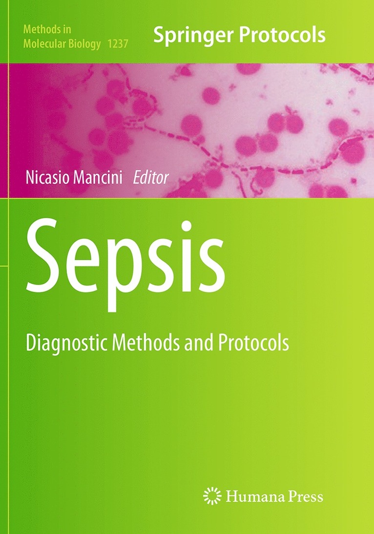 Sepsis