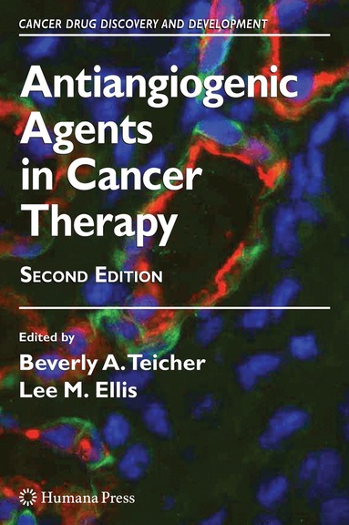 Beverly A. Teicher, Lee M. Ellis - Antiangiogenic Agents in Cancer Therapy, Häftad