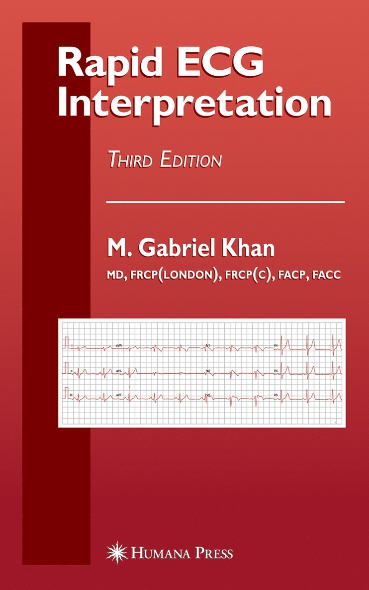 Rapid ECG Interpretation 1