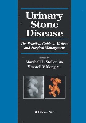 bokomslag Urinary Stone Disease