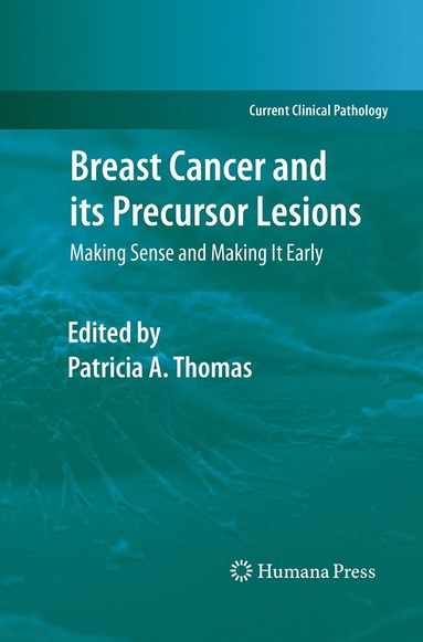 bokomslag Breast Cancer and its Precursor Lesions