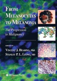 bokomslag From Melanocytes to Melanoma