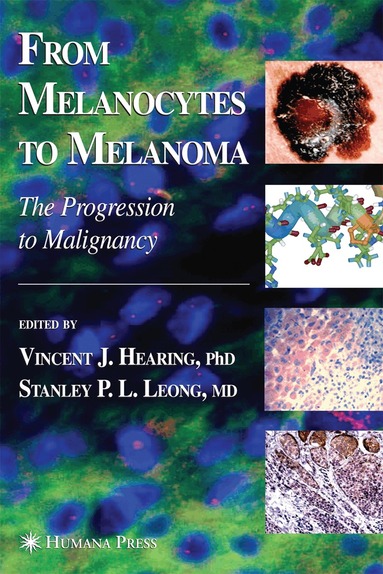 Vincent J. Hearing, Stanley P. L. Leong - From Melanocytes to Melanoma, Häftad