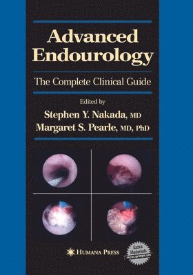 Advanced Endourology 1