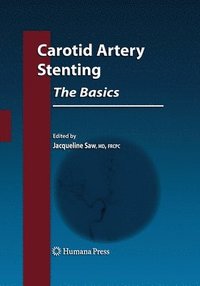 bokomslag Carotid Artery Stenting: The Basics