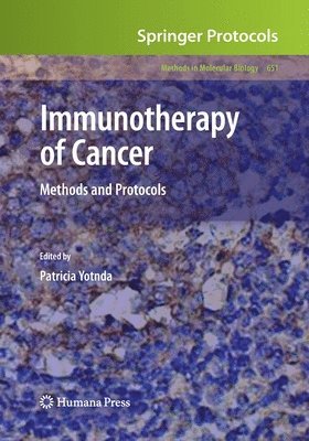 Immunotherapy of Cancer 1