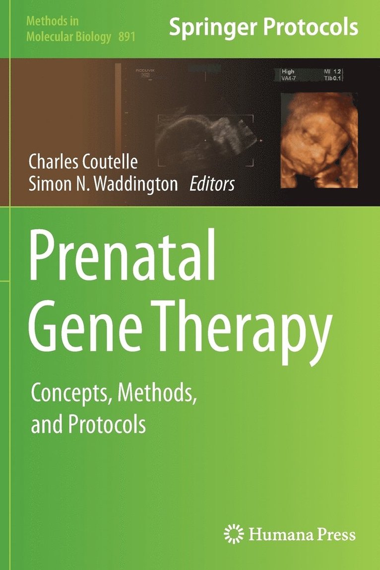 Prenatal Gene Therapy 1