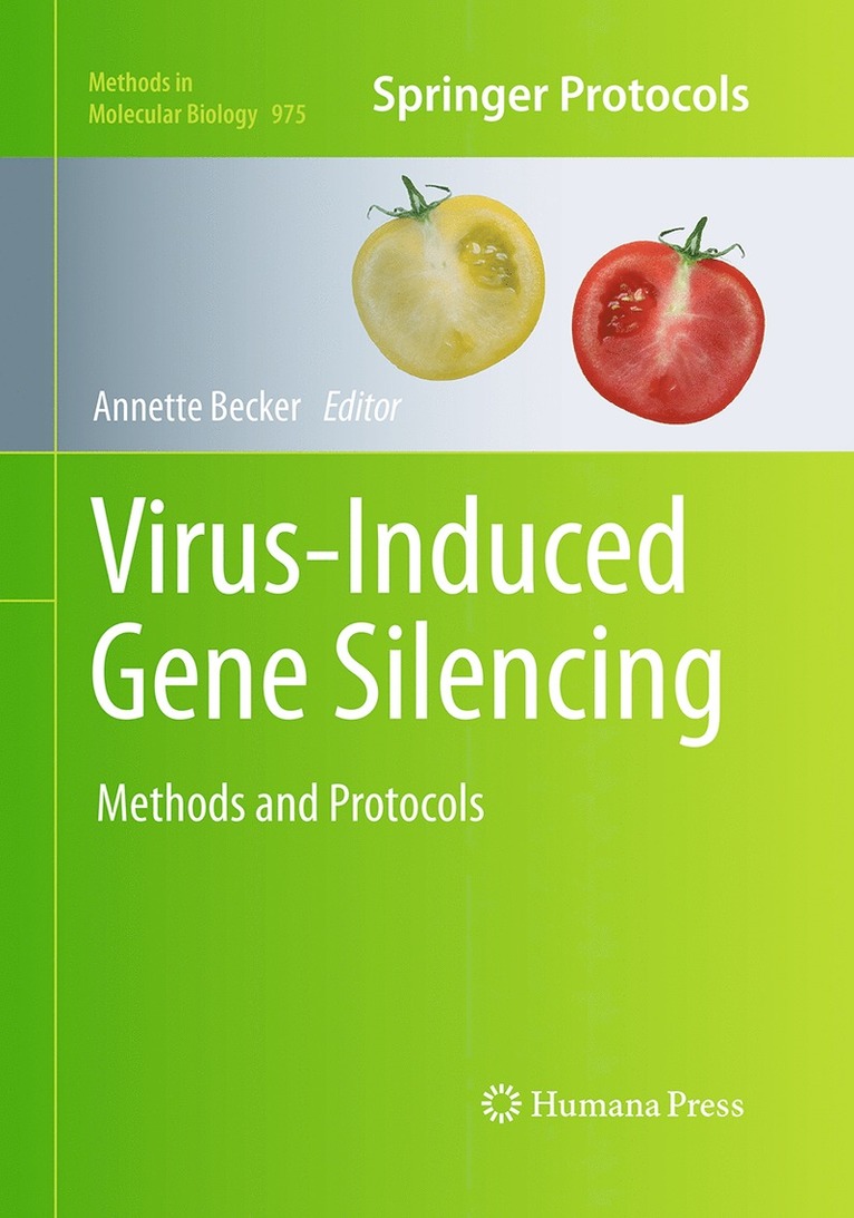 Diponkar Banerjee, Sohrab P. Shah - Array Comparative Genomic Hybridization, Häftad