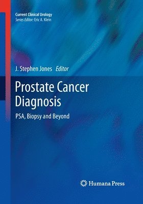 Prostate Cancer Diagnosis 1