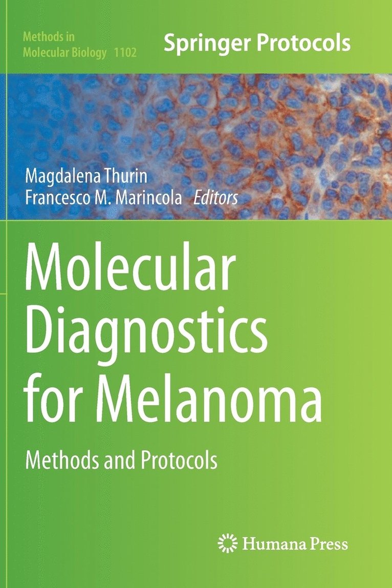 Molecular Diagnostics for Melanoma 1