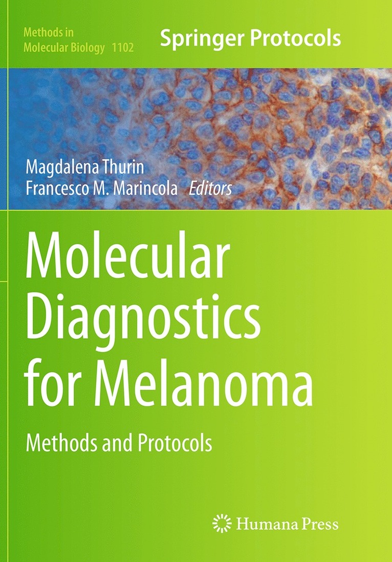 Magdalena Thurin, Francesco M. Marincola - Molecular Diagnostics for Melanoma, Häftad