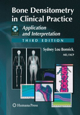 Bone Densitometry in Clinical Practice 1