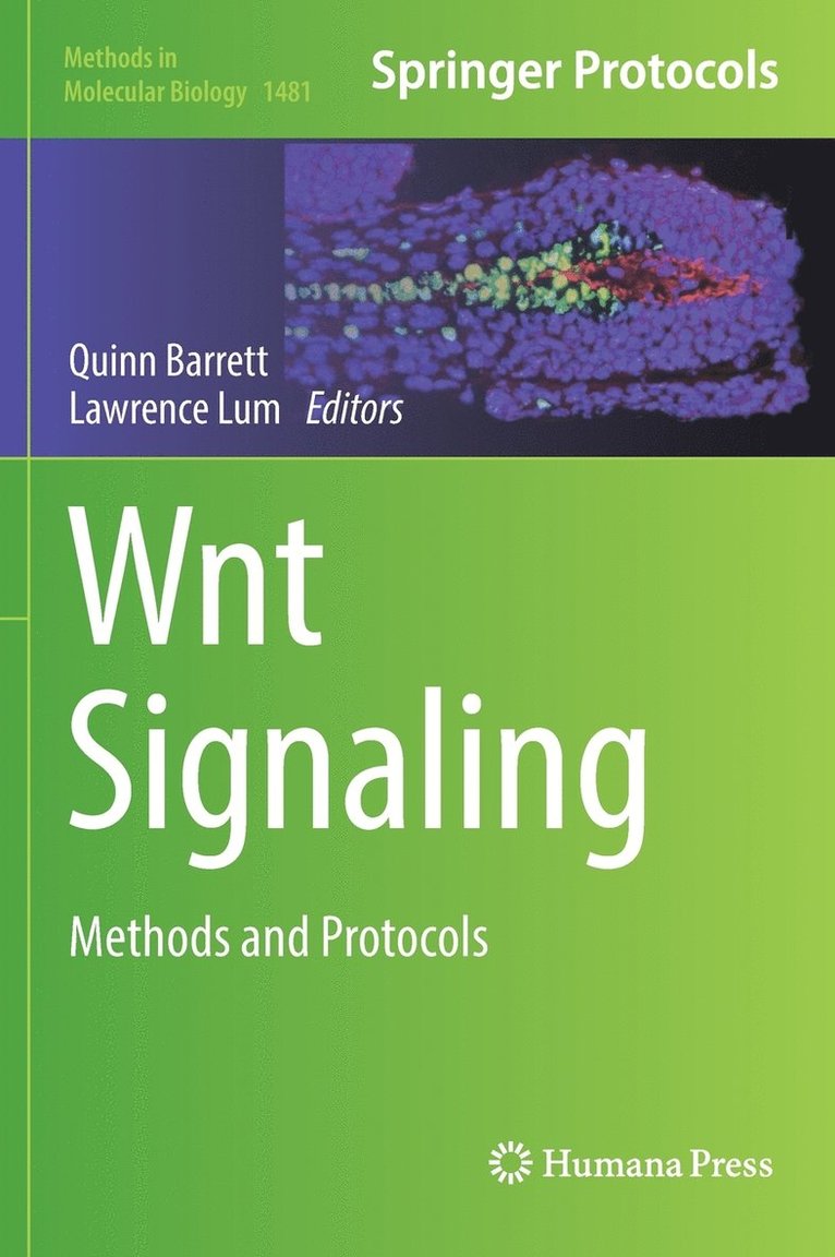 Wnt Signaling 1