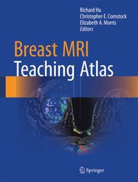bokomslag Breast MRI Teaching Atlas