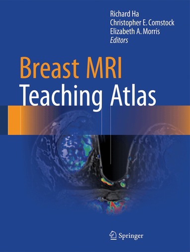 Richard Ha, Christopher E. Comstock, Elizabeth A. Morris - Breast MRI Teaching Atlas, Inbunden