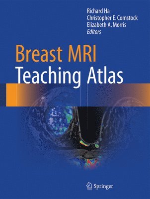 bokomslag Breast MRI Teaching Atlas