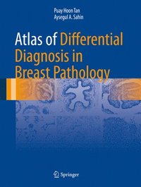 bokomslag Atlas of Differential Diagnosis in Breast Pathology