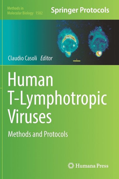 bokomslag Human T-Lymphotropic Viruses