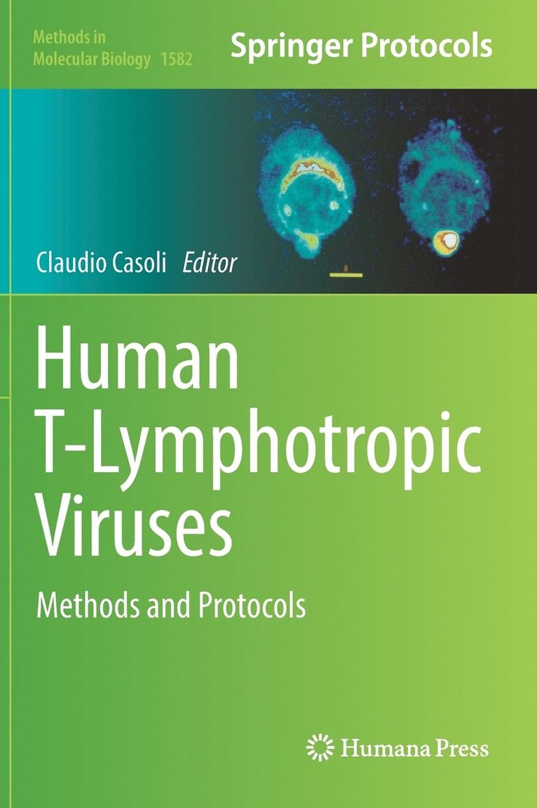 Human T-Lymphotropic Viruses 1