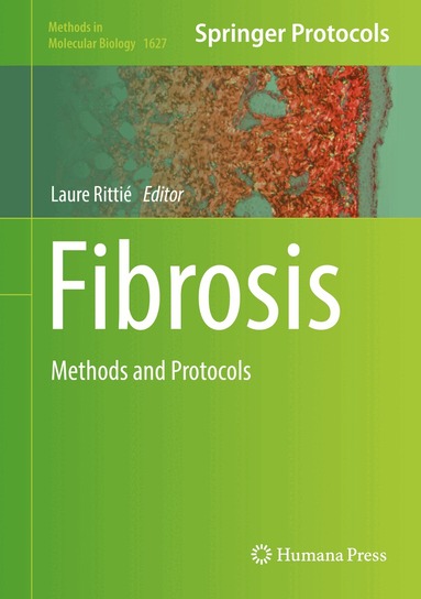 Laure Rittié - Fibrosis, Inbunden