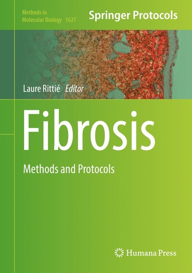 bokomslag Fibrosis