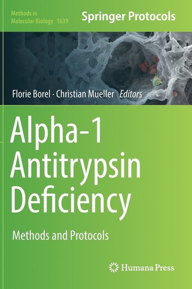 bokomslag Alpha-1 Antitrypsin Deficiency