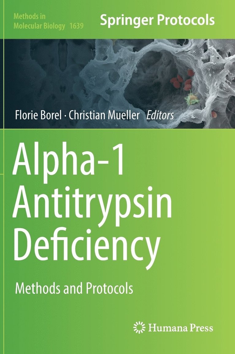 Alpha-1 Antitrypsin Deficiency 1