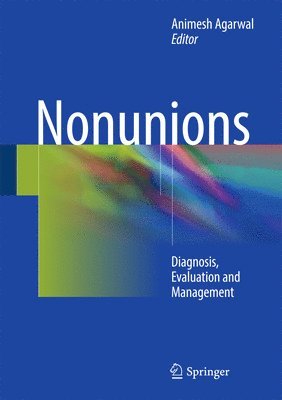 Nonunions 1