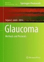 bokomslag Glaucoma