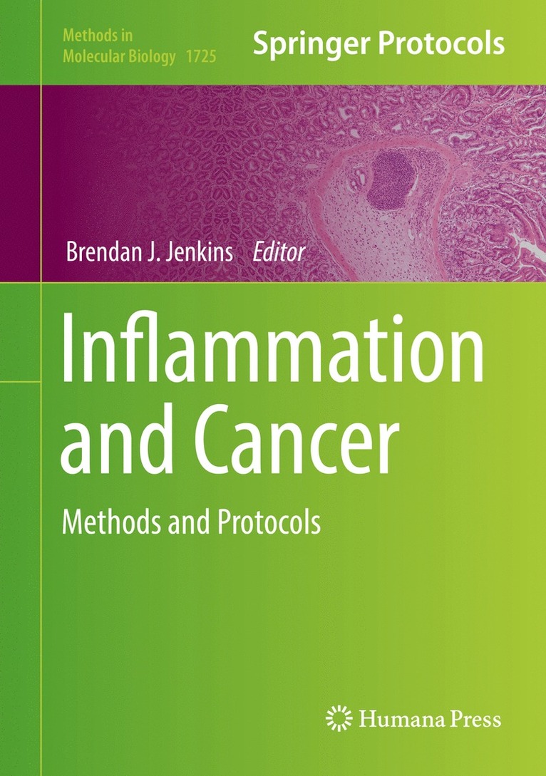 Inflammation and Cancer