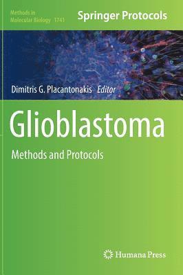 Dimitris G. Placantonakis - Glioblastoma, Inbunden