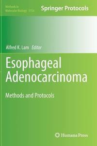 bokomslag Esophageal Adenocarcinoma