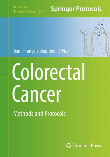 Jean-François Beaulieu - Colorectal Cancer, Inbunden