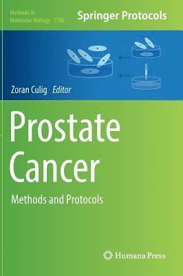 bokomslag Prostate Cancer