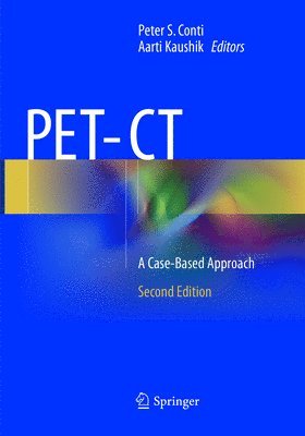 PET-CT 1