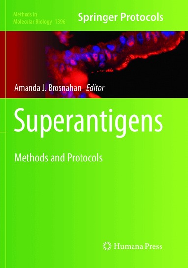 Amanda J. Brosnahan - Superantigens, Häftad