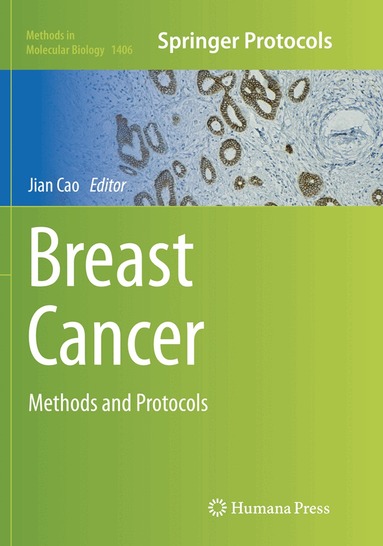 Jian Cao - Breast Cancer, Häftad