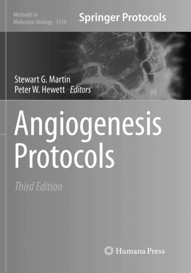 Stewart G. Martin, Peter W. Hewett - Angiogenesis Protocols, Häftad