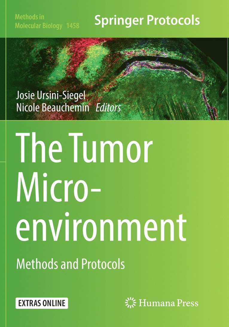 Josie Ursini-Siegel, Nicole Beauchemin - Tumor Microenvironment, Häftad