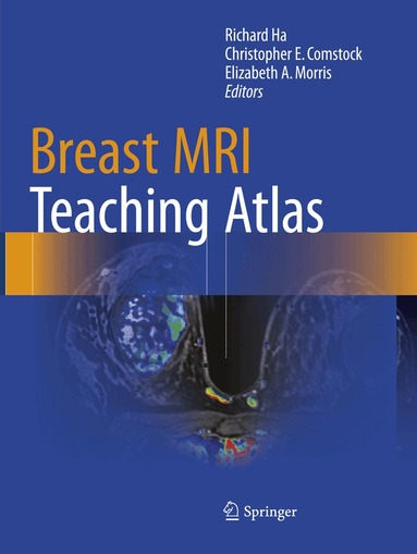 Richard Ha, Christopher E. Comstock, Elizabeth A. Morris - Breast MRI Teaching Atlas, Häftad