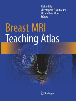 bokomslag Breast MRI Teaching Atlas