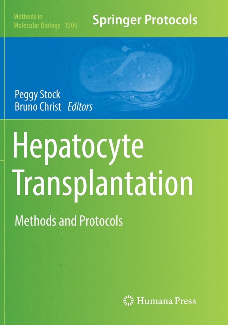 Peggy Stock, Bruno Christ - Hepatocyte Transplantation, Häftad