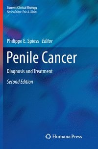 bokomslag Penile Cancer