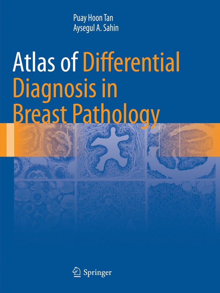Puay Hoon Tan, Aysegul A. Sahin - Atlas of Differential Diagnosis in Breast Pathology, Häftad