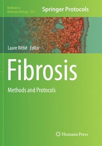 bokomslag Fibrosis