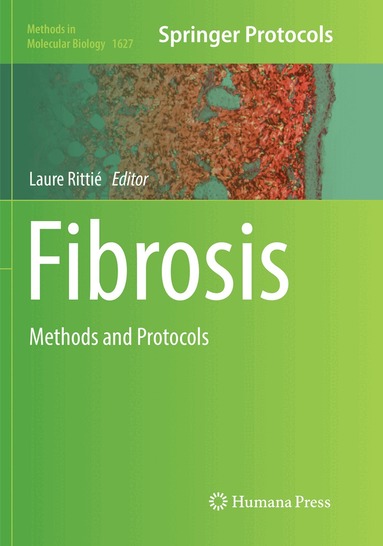 Laure Rittié - Fibrosis, Häftad