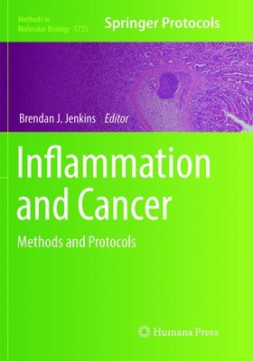 bokomslag Inflammation and Cancer