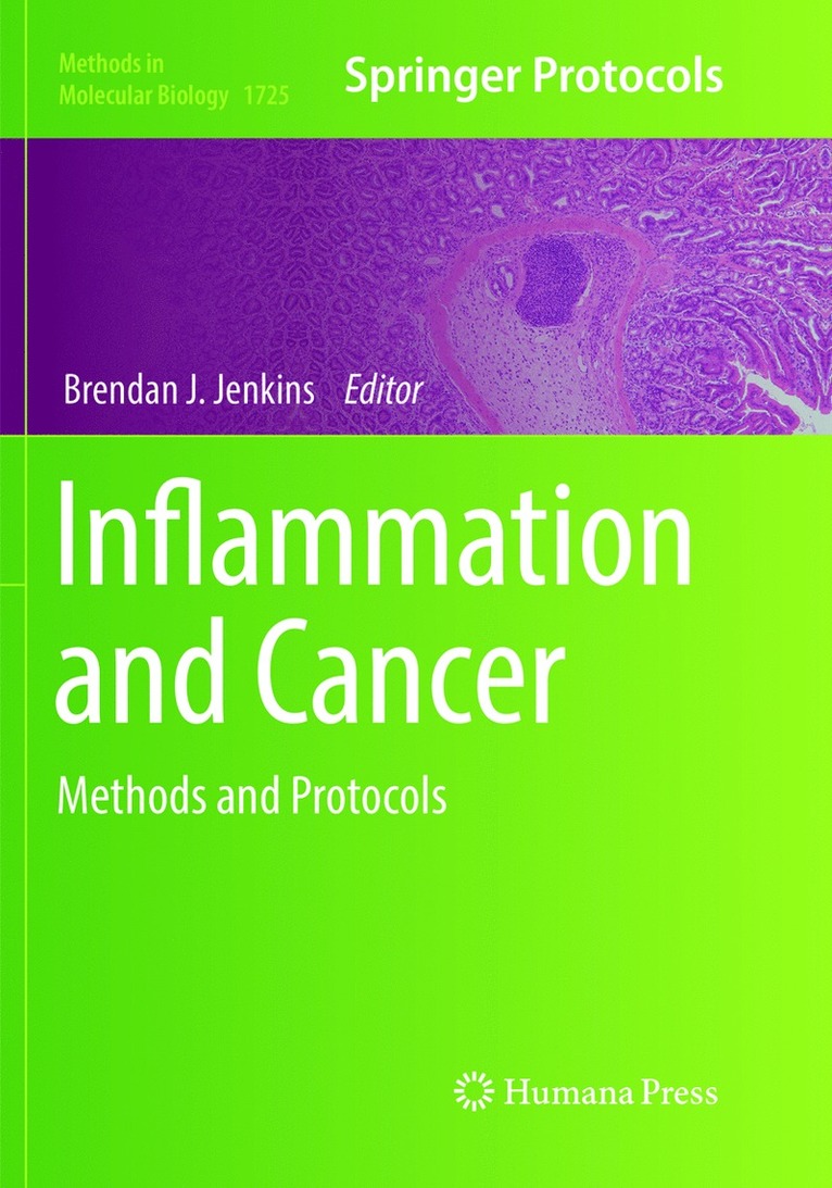 Inflammation and Cancer 1