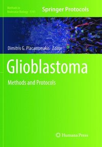bokomslag Glioblastoma